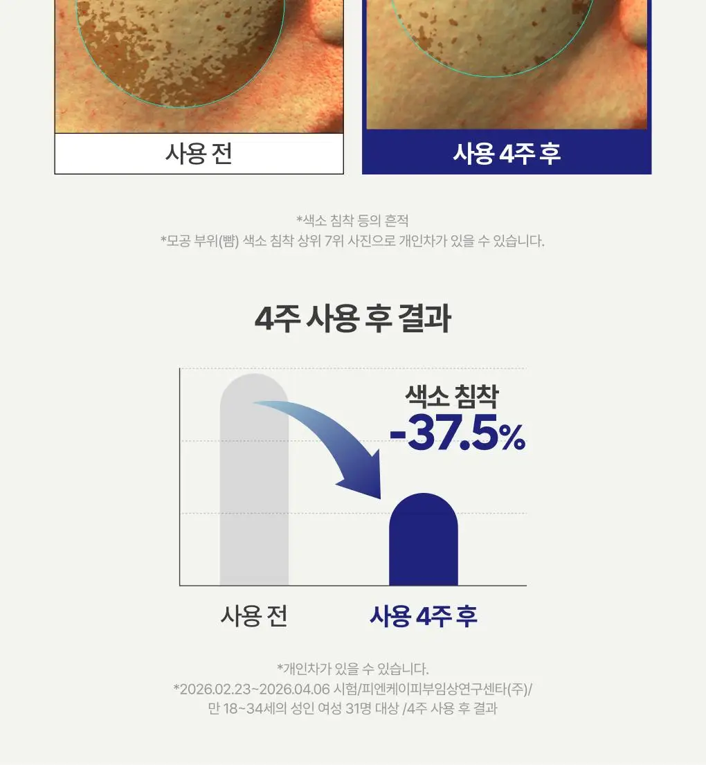 [1+1] 이니스프리 레티놀 시카 모공 흔적 앰플 30ml 리필기획(+30ml 리필) 상세페이지 27